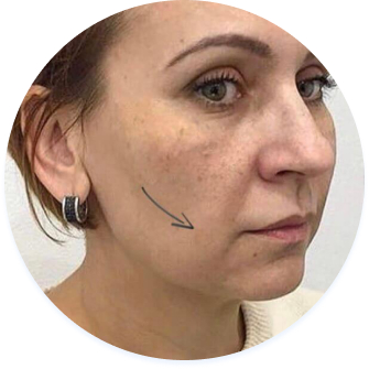 image before the procedure